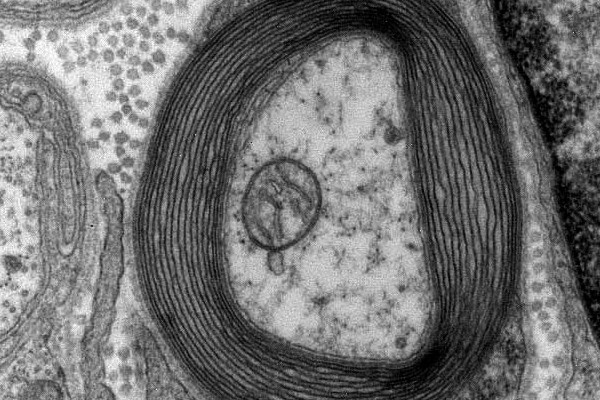 Transmission electron micrograph of a myelinated axon. Generated and deposited into the public domain by the Electron Microscopy Facility at Trinity College.