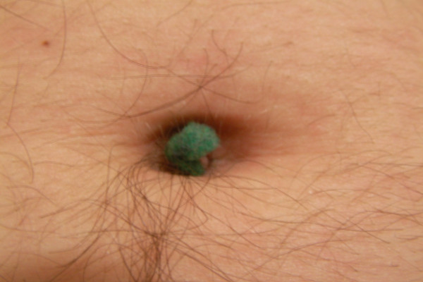  Navel lint (also known by names such as navel fluff, belly button lint and belly button fluff) is an accumulation of fluffy fibres in one's navel. Many people find that, at the beginning and end of the day, a small lump of fluff has appeared in the...