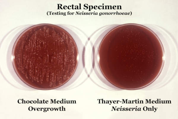 Neisseria gonorrhoeae bacteria