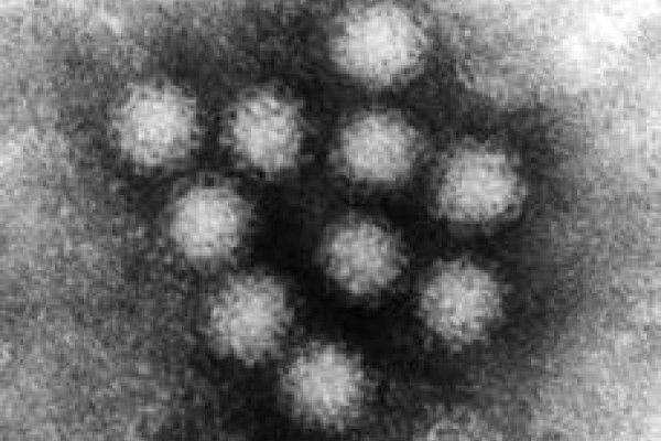 Norovirus, imaged by negative-stain Transmission Electron Microscopy. The bar scale is 50 nanometers