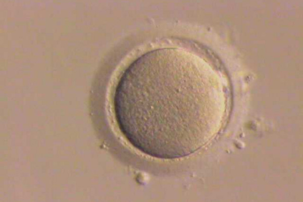 \Stripped\ human oocyte (egg cell); granulosa cells that had surrounded this oocyte have been removed.