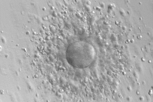 Human oocyte (egg cell) with surrounding granulosa cells, after aspiration