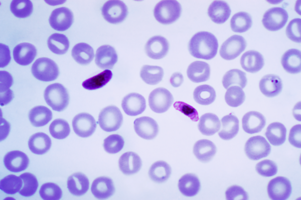  This photomicrograph of a blood smear contains a macro- and microgametocyte of the Plasmodium falciparum parasite. Both macro- and microgametocytes are products of the erythrocytic life cycle. Within a few minutes after the Anopheles sp. vector...