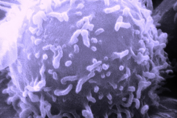 Electron microscopic image of a single human lymphocyte.