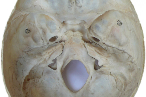 Human Neurocranium - Good Bowl?