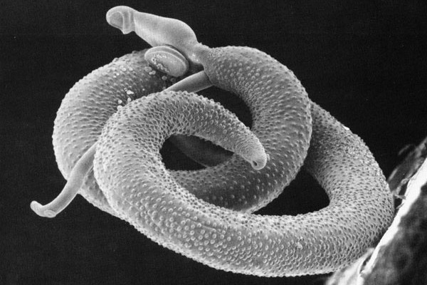 Schistosoma mansoni, the cause of the disease bilharzia