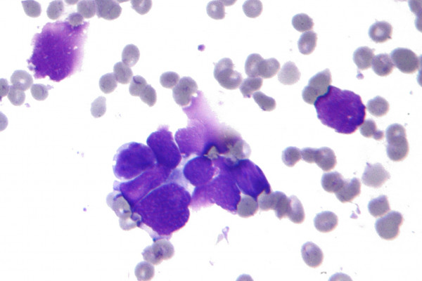 Small cell lung cancer cells