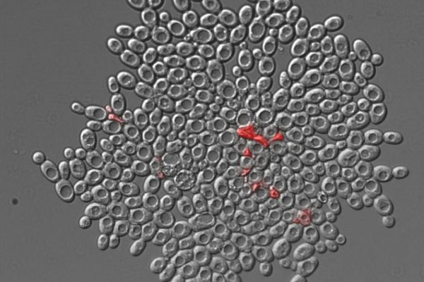 A snowflake yeast cluster with dead cells labeled red.