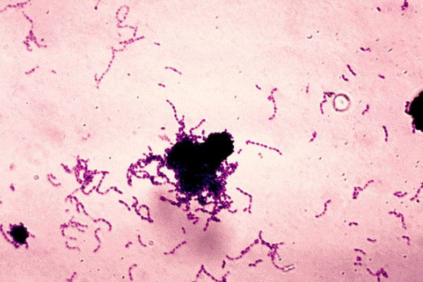 Gram stained Streptococcus mutans