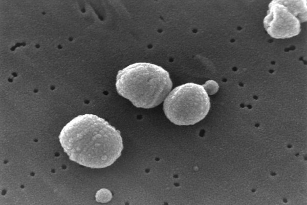 Scanning Electron Micrograph of Streptococcus pneumoniae. Pneumococcus, Streptococci