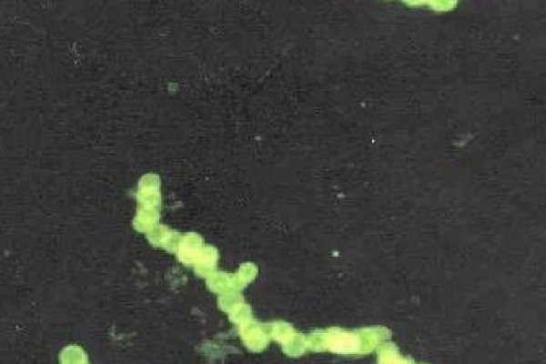 Sulphide bacteria