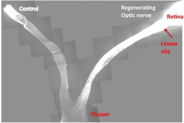  This slide is the composite images from multiple sections that cover both control and injured eyes, optic nerves and the chiasm. In contrast to the control, where no regenerating axons pass the lesion site in the left, PTEN/SOCS3 double deletion...