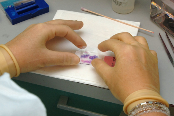 Preparing a tissue sample on a slide