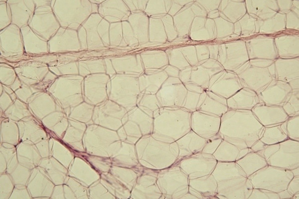 Fat cells in adipose tissue