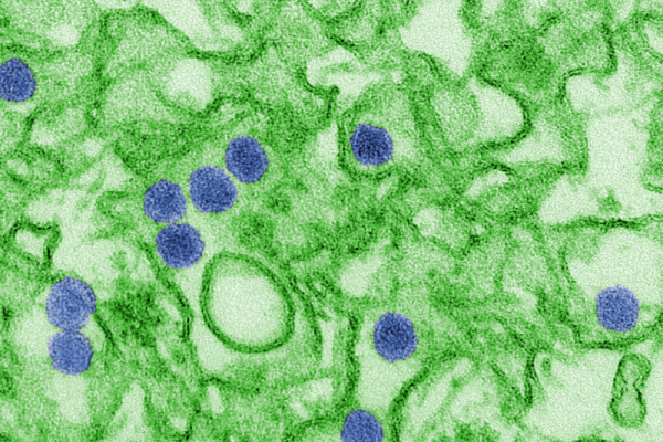 Digitally-colorized transmission electron micrograph (TEM) of Zika virus, which is a member of the family Flaviviridae. Virus particles, here colored blue, are 40 nm in diameter, with an outer envelope, and an inner dense core.