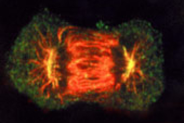 Figure 1: A tumour is formed when cells divide out of control.