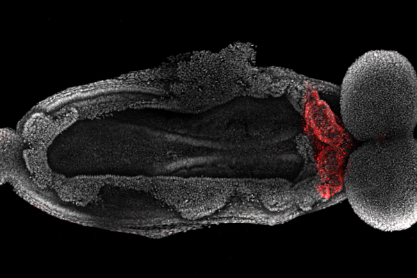 The heart forming in a mouse embryo