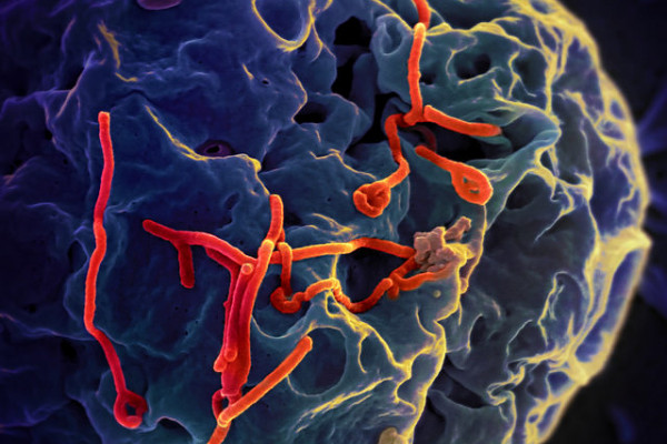 Ebola Virus