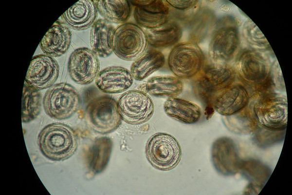 The eggs of Myrmeconema neotropicum, a nematode parasite which causes the rear end of their ant host to resemble a ripe juicy berry.