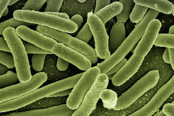 Esterichia coli bacteria.