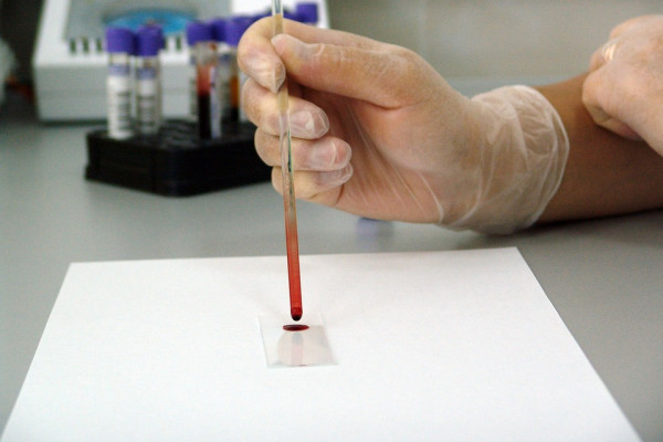 a blood sample on a slide in a lab