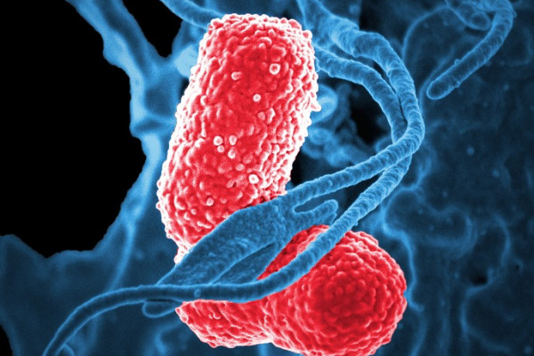 Klebsiella Pneumoniae Bacteria