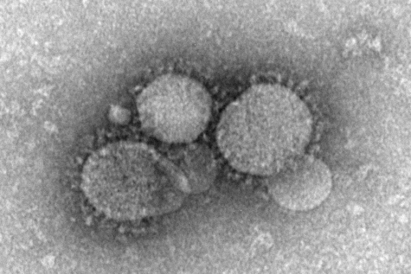 Transmission electron microscopic (TEM) image of Middle East respiratory syndrome coronavirus (MERS-CoV), which was identified in 2012, as the cause of respiratory illness in people.