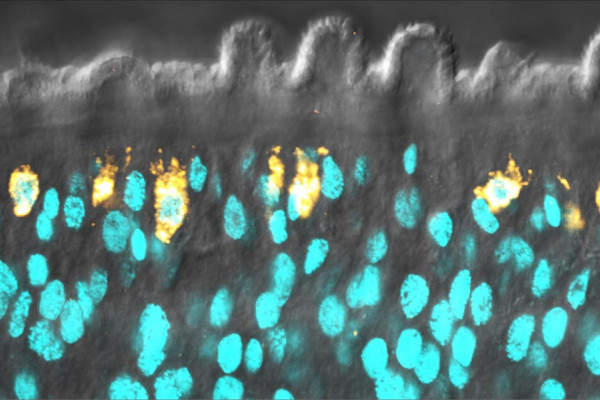 Schistosome stem cells