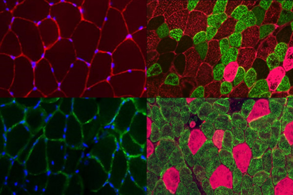 Gastrocnemius muscle in a mouse