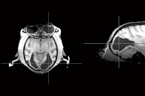 Brain scan of a monkey that could still see but lacked a primary visual cortex