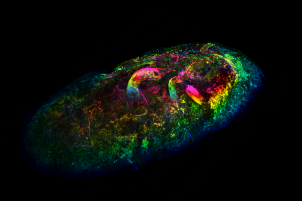 Failure of trophoblast cells to invade maternal uterine spiral arteries is linked with pre-eclampsia.