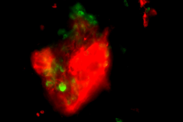 An in vitro toxoplasma tissue cyst, 20 days post infection.