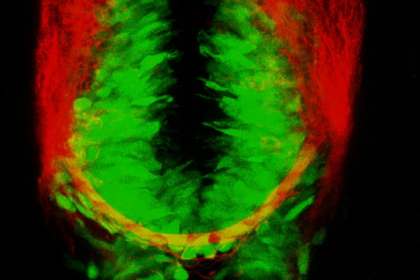 Green inhibitory and red excitatory cells glowing in a live zebrafish brain.