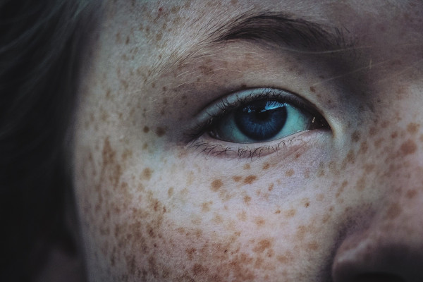 A freckled face