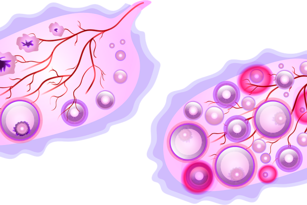 Graphic of the ovary with maturing follicles