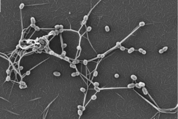 Streptococcus pyogenes bacteria make chemical harpoons to anchor themselves to host cells