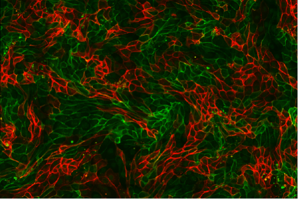 Epithelial cells