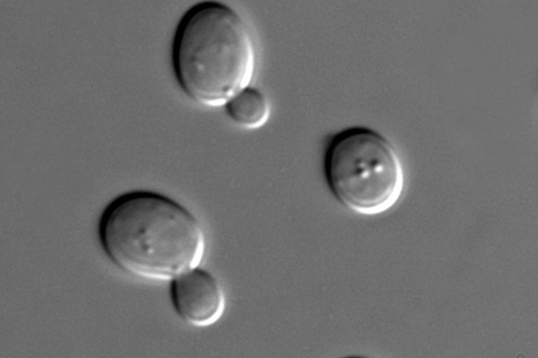 Saccharomyces cerevisiae cells in DIC microscopy.