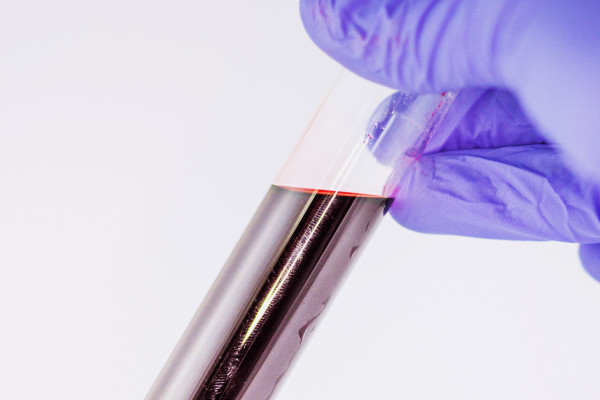 A test tube containing a blood sample