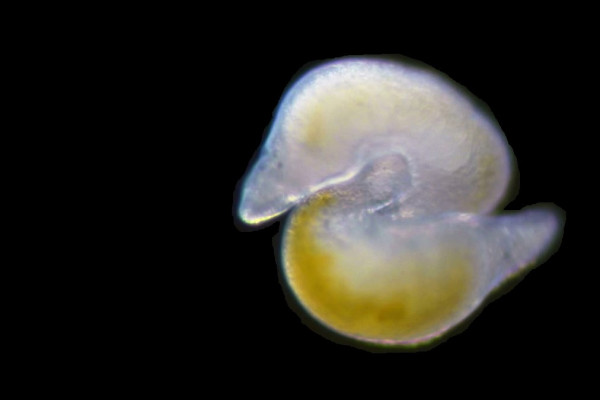 The regenerative abilities of the flatworm Macrostomum lignano serve as a model for how humans might regenerate tissues. 