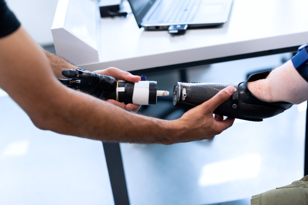 A prosthetic arm