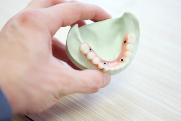 Dentist hold dental implant