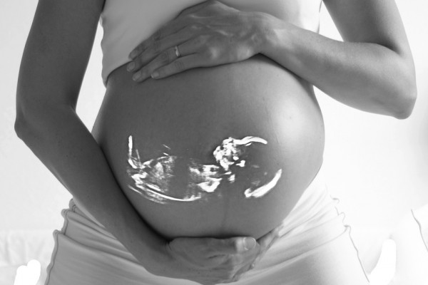 Ultrasound on pregnant lady