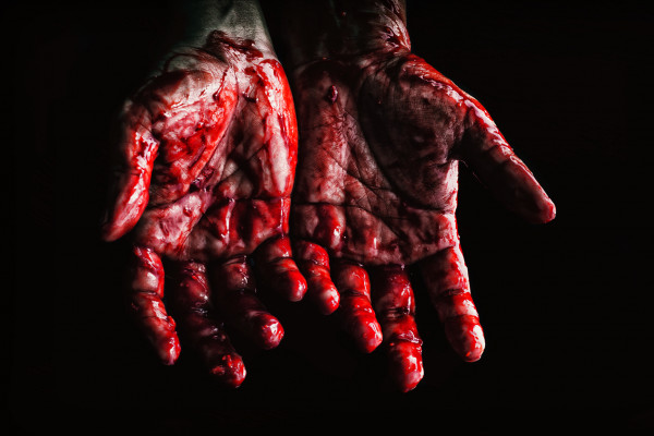 Hands covered in blood