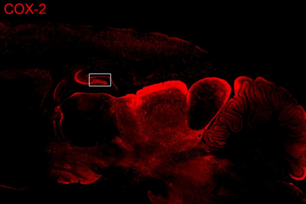 Rat brain COX-2 activity during a seizure.