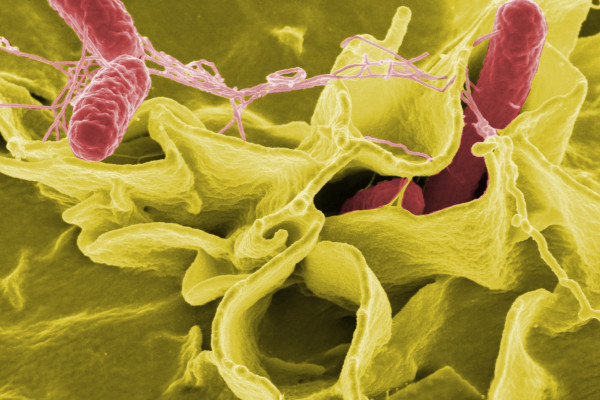 Colour-enhanced scanning electron micrograph showing Salmonella typhimurium (red) invading cultured human cells