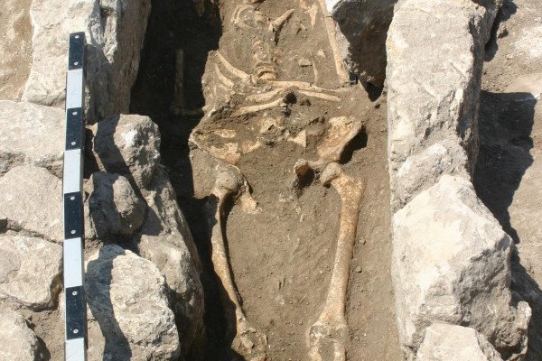 Skeleton with evidence of infection in pregnancy, from Troy.