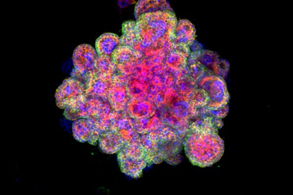 microscope image of a placenta organoid