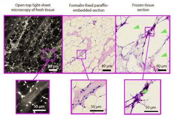 Light sheet microscopy compared with traditional microscopy