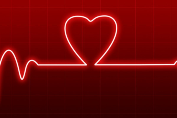 ECG Trace